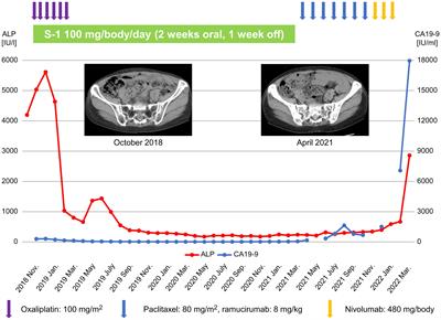 Long-term survival of a patient with gastric cancer with bone marrow metastasis receiving S-1 plus oxaliplatin beyond three years: a case report and literature review